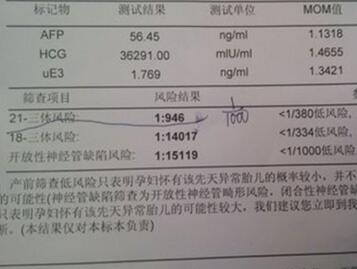 羊水穿刺多久出结果