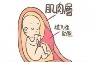 胎盘植入是什么意思