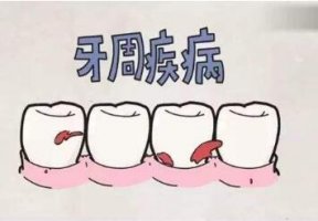 儿童牙周炎有什么危害