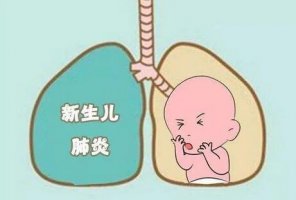 新生儿重症肺炎
