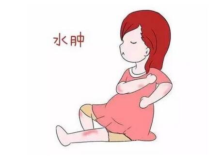 孕妇水肿怎么办