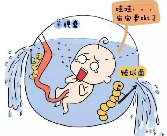 什么是孕期破水？高位破水的5大明显特征