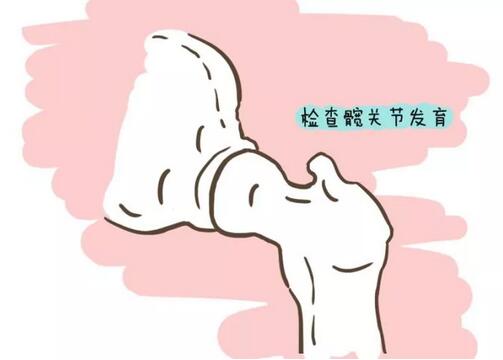 宝宝关节响是怎么回事