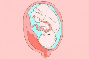 哪些因素影响胎儿大小？