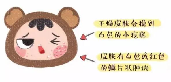 什么是胎毒