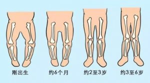 宝宝标准腿型长什么样？