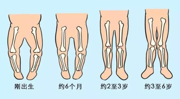 宝宝标准腿型长什么样