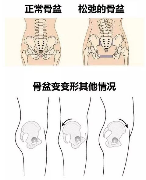 产后恢复的正确顺序，你知道吗？