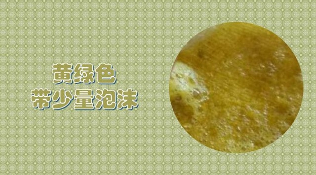 11种宝宝大便绿色的原因及改善方式