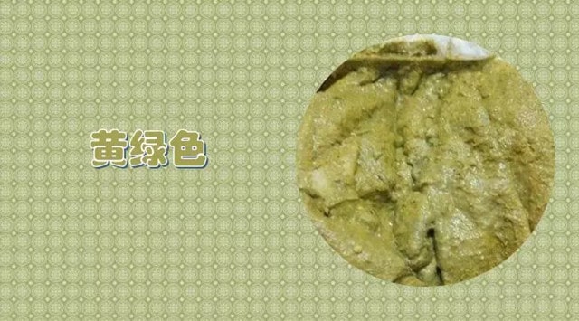 11种宝宝大便绿色的原因及改善方式