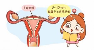 子宫内膜增厚的5个办法