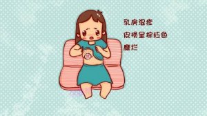 乳房湿疹怎么办