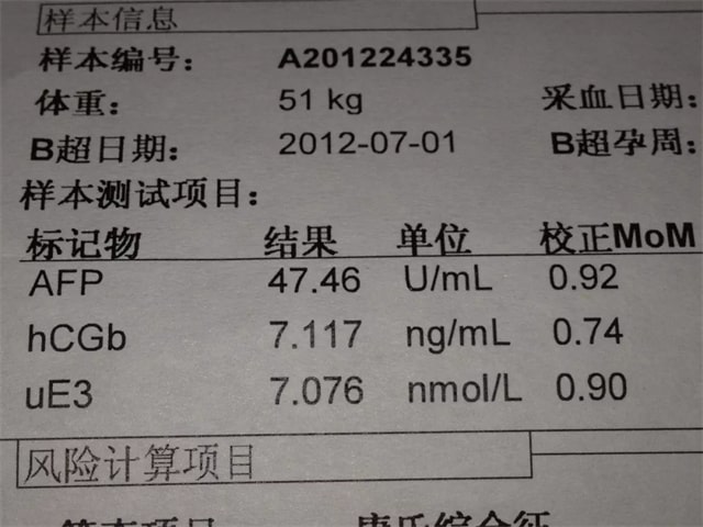 孕期必做的5次产检项目