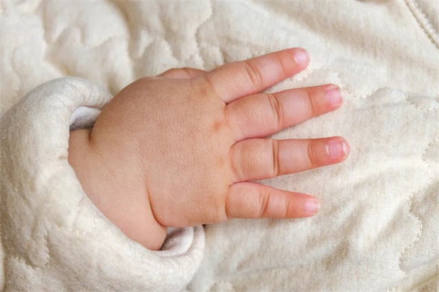 宝宝指甲透露的5种健康信号