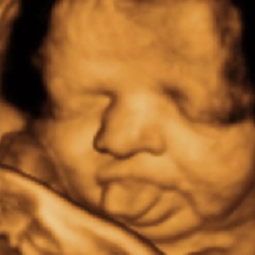 胎儿无聊时在妈妈肚子里都干点啥？