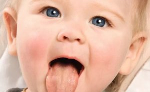 宝宝舌苔厚白是什么原因引起的怎么解决