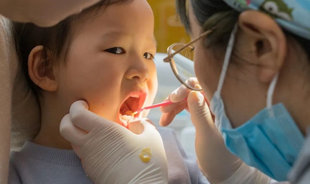 怎样才能有效预防儿童蛀牙