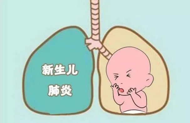 新生儿肺炎是什么原因引起的
