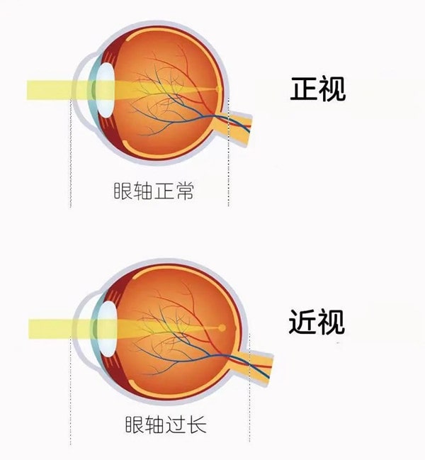 儿童预防近视，从室内正确用眼习惯开始
